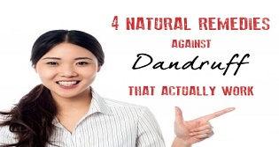 Home Remedies for Dandruff