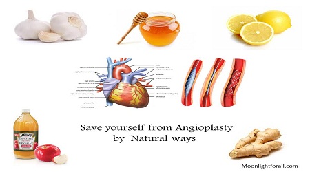 Save yourself from angioplasty
