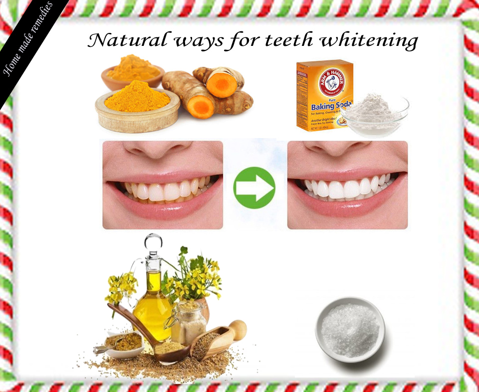 whitening your teeth home safely